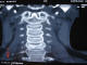 كرم ابريشم:  بازسازي كورونال در CT گردن