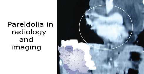 Pareidolia-in-radiology-and-imaging-slideshow