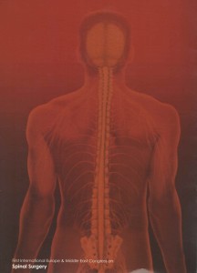 spinal1 